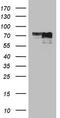 MYCN Proto-Oncogene, BHLH Transcription Factor antibody, TA809361, Origene, Western Blot image 
