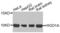 HIG1 Hypoxia Inducible Domain Family Member 1A antibody, abx002441, Abbexa, Western Blot image 