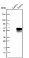 Mitochondrial Calcium Uptake Family Member 3 antibody, NBP1-85154, Novus Biologicals, Western Blot image 