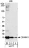 CRABP-II antibody, A300-809A, Bethyl Labs, Western Blot image 
