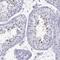 Actin-like protein 7A antibody, NBP1-86014, Novus Biologicals, Immunohistochemistry paraffin image 