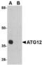 Autophagy Related 12 antibody, TA306512, Origene, Western Blot image 