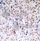 RB Transcriptional Corepressor 1 antibody, AP0174, ABclonal Technology, Immunohistochemistry paraffin image 