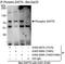 Zeta Chain Of T Cell Receptor Associated Protein Kinase 70 antibody, A302-007A, Bethyl Labs, Immunoprecipitation image 