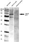 ARF GTPase-activating protein GIT1 antibody, TA326533, Origene, Western Blot image 