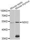 NIMA Related Kinase 2 antibody, orb167269, Biorbyt, Western Blot image 