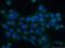 Calcium-transporting ATPase type 2C member 1 antibody, 13310-1-AP, Proteintech Group, Immunofluorescence image 