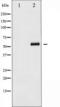 M-phase inducer phosphatase 2 antibody, TA325332, Origene, Western Blot image 