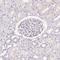 CD208 antibody, HPA051467, Atlas Antibodies, Immunohistochemistry frozen image 