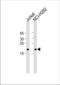 TATA-Box Binding Protein Associated Factor 10 antibody, TA324657, Origene, Western Blot image 