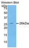 Spectrin alpha chain, brain antibody, LS-C292773, Lifespan Biosciences, Western Blot image 