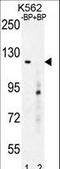 DEP Domain Containing 5 antibody, LS-B9330, Lifespan Biosciences, Western Blot image 