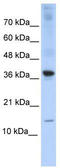 Basic Leucine Zipper ATF-Like Transcription Factor antibody, TA331156, Origene, Western Blot image 