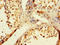 DNA Polymerase Beta antibody, A63170-100, Epigentek, Immunohistochemistry paraffin image 