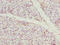Coiled-Coil Domain Containing 89 antibody, CSB-PA818737LA01HU, Cusabio, Immunohistochemistry paraffin image 