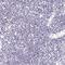 ATPase H+ Transporting V0 Subunit D2 antibody, HPA055327, Atlas Antibodies, Immunohistochemistry paraffin image 