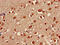 SHOC2 Leucine Rich Repeat Scaffold Protein antibody, LS-C679454, Lifespan Biosciences, Immunohistochemistry paraffin image 