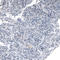 ATP Binding Cassette Subfamily D Member 3 antibody, AMAb90995, Atlas Antibodies, Immunohistochemistry paraffin image 