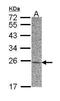 Adenylate Kinase 1 antibody, PA5-28354, Invitrogen Antibodies, Western Blot image 