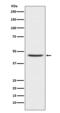 C-C Motif Chemokine Receptor 8 antibody, M03518, Boster Biological Technology, Western Blot image 