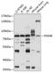 Phosphodiesterase 4B antibody, GTX17609, GeneTex, Western Blot image 