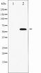 PXN antibody, TA327869, Origene, Western Blot image 