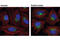 Golgin subfamily A member 2 antibody, 12480T, Cell Signaling Technology, Immunofluorescence image 