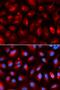 Kinesin Light Chain 1 antibody, orb167421, Biorbyt, Immunofluorescence image 
