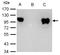 Glucocorticoid Receptor beta antibody, LS-B12450, Lifespan Biosciences, Immunoprecipitation image 