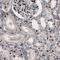 AT-Rich Interaction Domain 1A antibody, AMAb91192, Atlas Antibodies, Immunohistochemistry paraffin image 