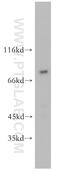 Sodium/hydrogen exchanger 8 antibody, 18318-1-AP, Proteintech Group, Western Blot image 