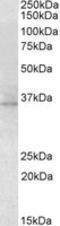 11-cis retinol dehydrogenase antibody, LS-B9519, Lifespan Biosciences, Western Blot image 