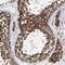 Cilia And Flagella Associated Protein 46 antibody, HPA038868, Atlas Antibodies, Immunohistochemistry frozen image 