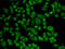 Aldehyde dehydrogenase, mitochondrial antibody, LS-C331368, Lifespan Biosciences, Immunofluorescence image 