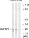E3 ubiquitin-protein ligase RNF125 antibody, A30664, Boster Biological Technology, Western Blot image 