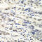 Nudix Hydrolase 1 antibody, LS-C335577, Lifespan Biosciences, Immunohistochemistry paraffin image 