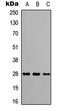 Calpain Small Subunit 2 antibody, LS-C354299, Lifespan Biosciences, Western Blot image 