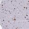 Survival Of Motor Neuron 2, Centromeric antibody, NBP2-46712, Novus Biologicals, Immunohistochemistry frozen image 