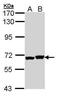 Dihydropyrimidinase Like 5 antibody, PA5-29475, Invitrogen Antibodies, Western Blot image 