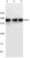 Histone Deacetylase 9 antibody, A02177, Boster Biological Technology, Western Blot image 