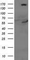 Cytochrome P450 Family 2 Subfamily J Member 2 antibody, CF503515, Origene, Western Blot image 