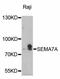 Semaphorin 7A (John Milton Hagen Blood Group) antibody, STJ113940, St John