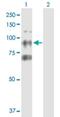 CTAGE Family Member 6 antibody, H00340307-B01P, Novus Biologicals, Western Blot image 