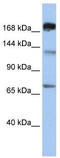5-Methyltetrahydrofolate-Homocysteine Methyltransferase antibody, TA346670, Origene, Western Blot image 