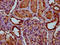 Inter-Alpha-Trypsin Inhibitor Heavy Chain 3 antibody, LS-C680696, Lifespan Biosciences, Immunohistochemistry paraffin image 
