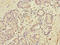 Dual Oxidase 1 antibody, LS-C675670, Lifespan Biosciences, Immunohistochemistry paraffin image 