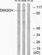 Dimethylglycine dehydrogenase, mitochondrial antibody, A30641, Boster Biological Technology, Western Blot image 