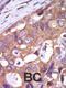 Protein Kinase D1 antibody, 62-597, ProSci, Immunohistochemistry paraffin image 