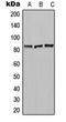 Carboxypeptidase N subunit 2 antibody, orb213772, Biorbyt, Western Blot image 
