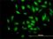 Phosphodiesterase 4D Interacting Protein antibody, H00009659-M01, Novus Biologicals, Immunofluorescence image 